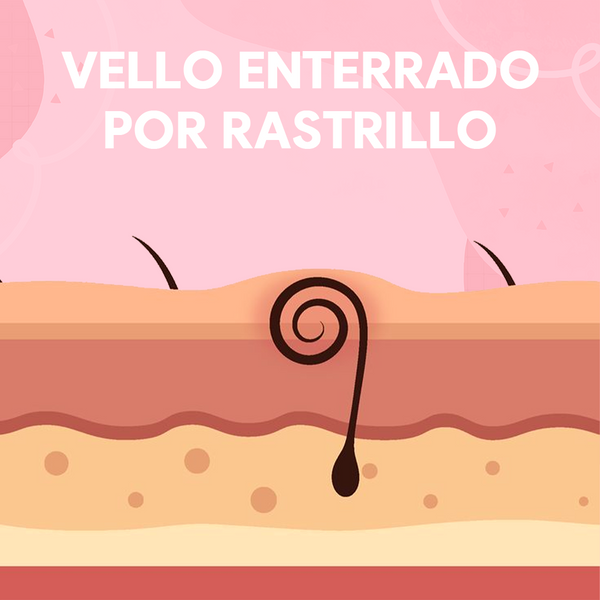 Kit 1minpretty: 2 tarros de cera + fundidor + refill + extras + talco para depilar con envío gratis mx